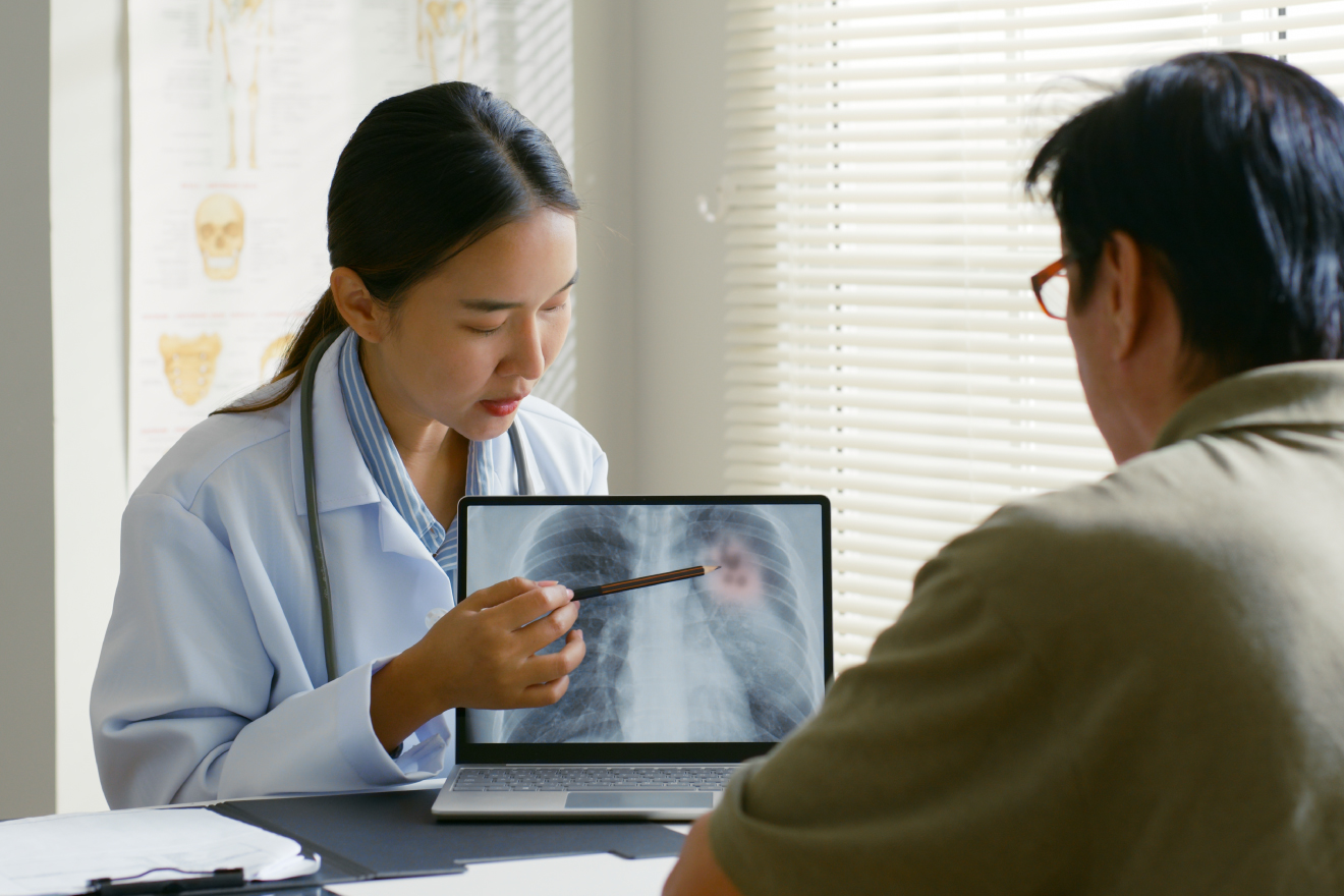 肺真菌症の治療法を理解しよう
                        