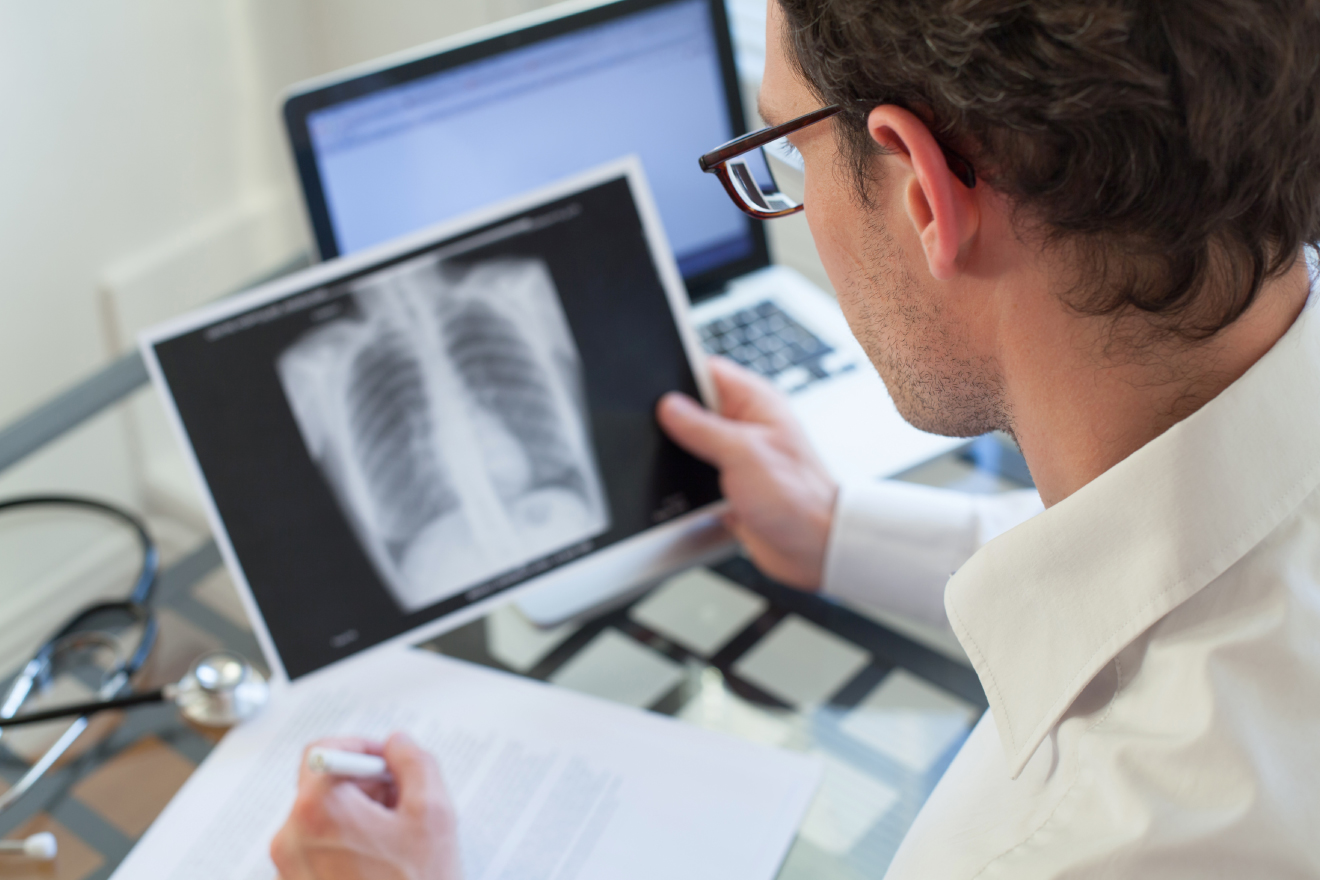 肺炎の症状について理解しよう 
                        